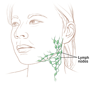 Three-quarter view of woman's head showing lymph nodes in neck.